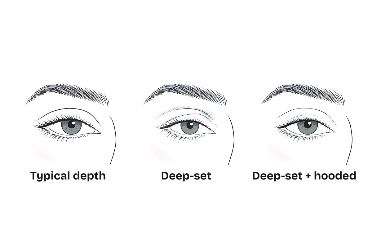 Three eyes compared, labeled: typical depth; deep-set, sitting further back under the brow bone; and deep-set and hooded together.