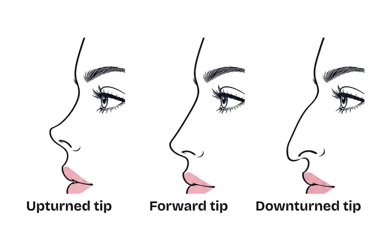Three close-up nose profiles side by side, labeled upturned tip, forward tip and downturned tip.