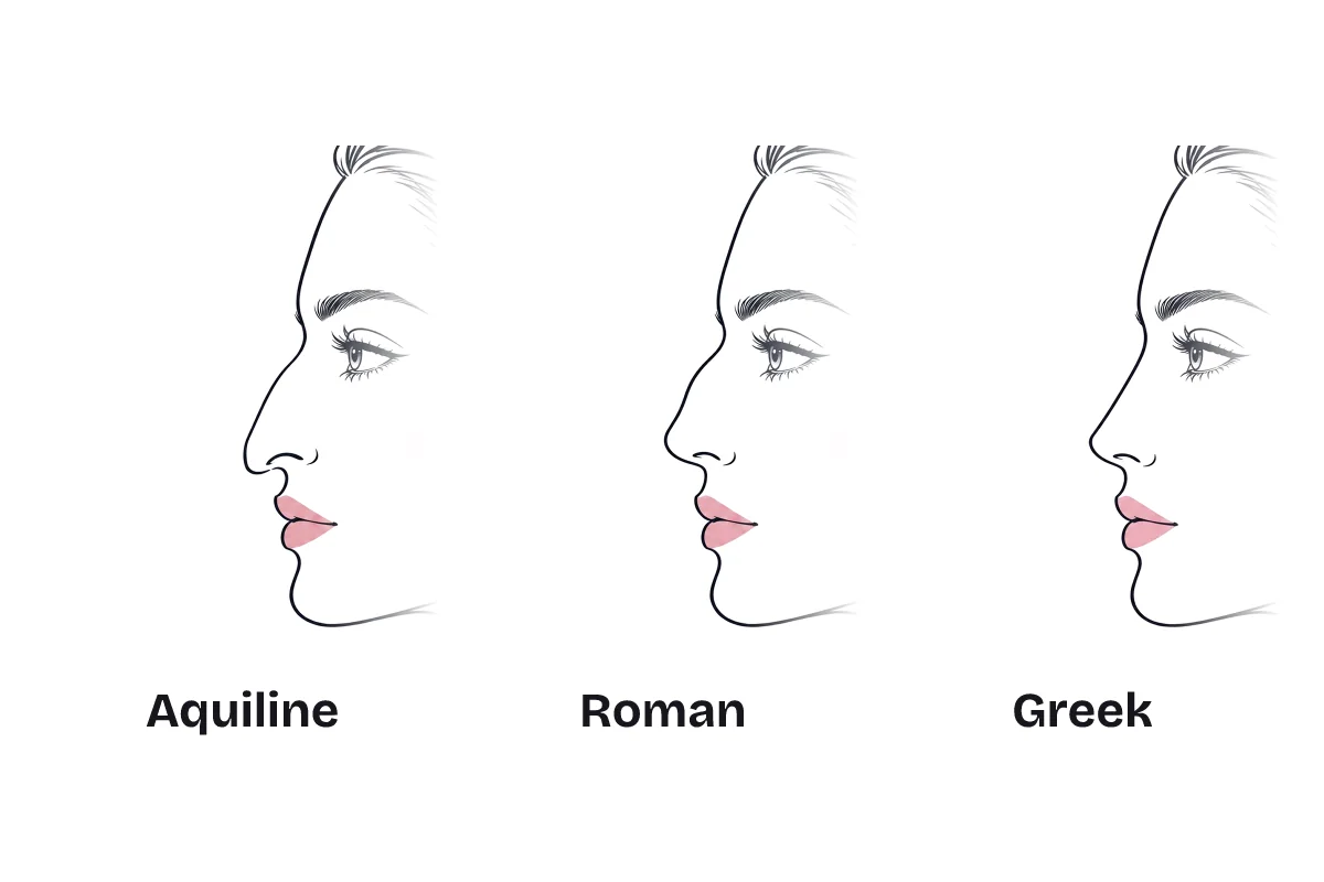 The same side profile drawn with three noses, labeled: aquiline, with a pronounced curve and a downward tip; Roman, with a gentle curve; and Greek, with a straight bridge.