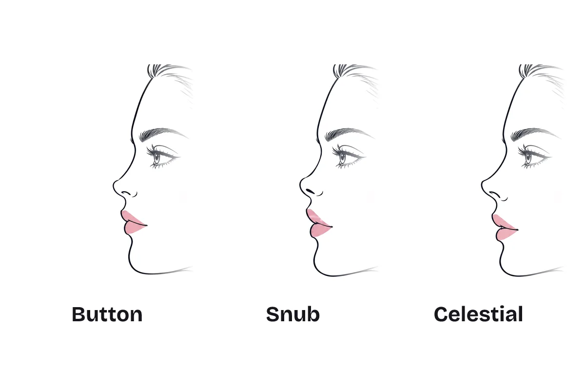 The same side profile drawn with three noses, labeled: button, small with a rounded tip; snub, with a scooped bridge and an upturned tip; and celestial, with a gently scooped bridge and a defined upturned tip.