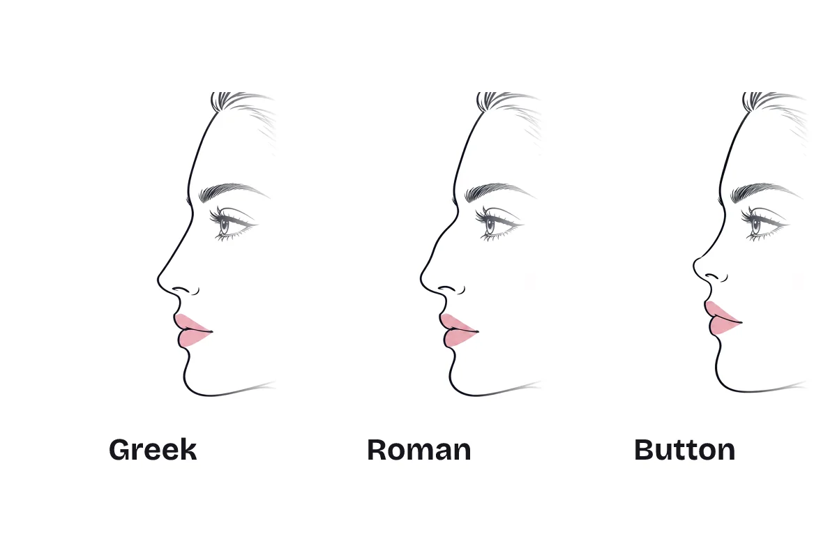 The same side profile drawn with three noses, labeled: Greek, with a straight bridge; Roman, with a gentle outward curve; and button, short with a small, upturned tip.