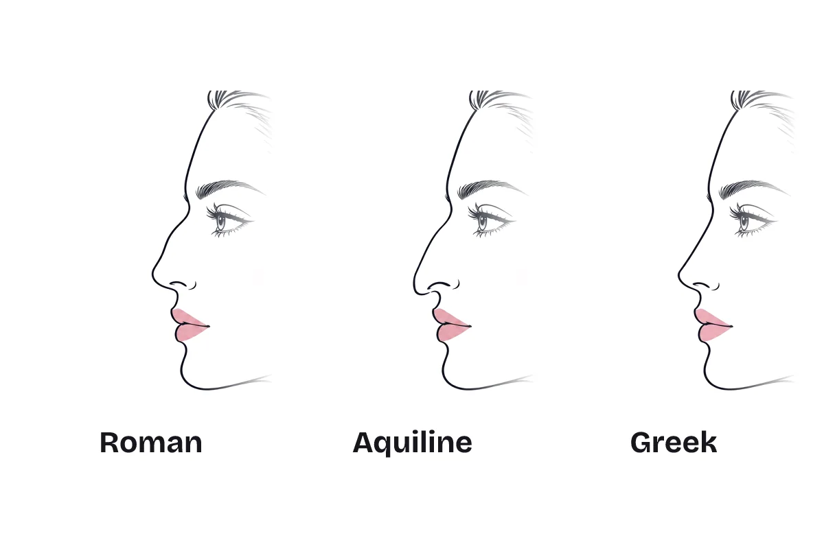 The same side profile drawn with three noses, labeled: Roman, with a gentle curve; aquiline, with a pronounced curve and a downward tip; and Greek, with a straight bridge.
